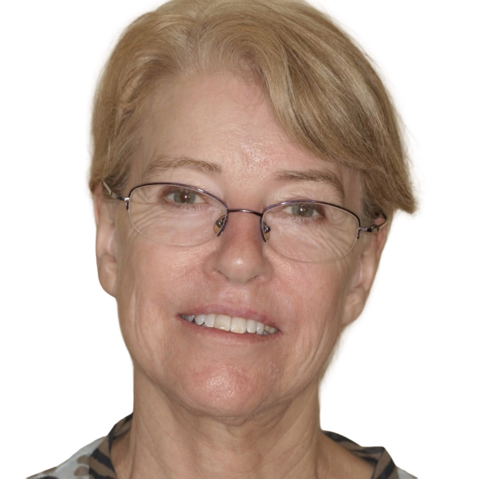 Patient smile before treatment