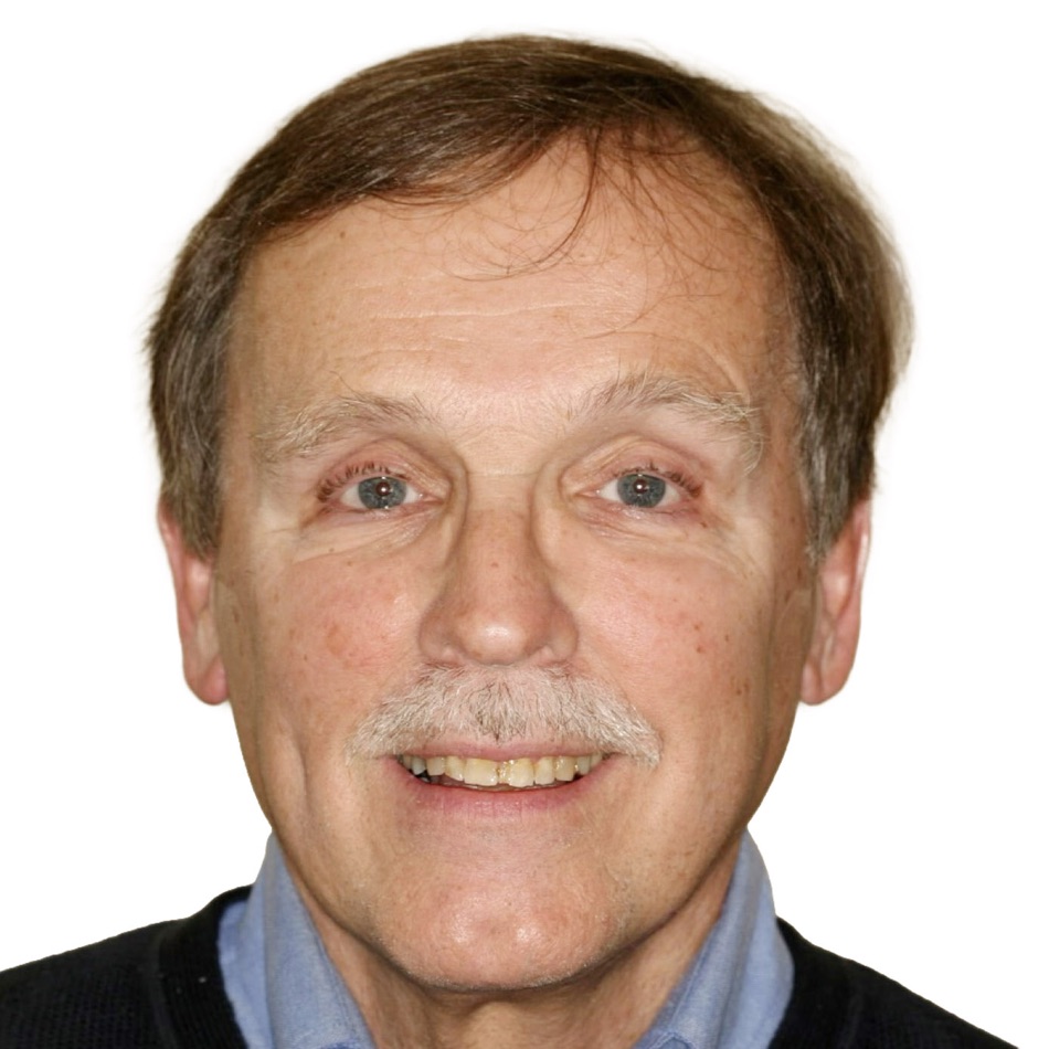 Patient smile before treatment