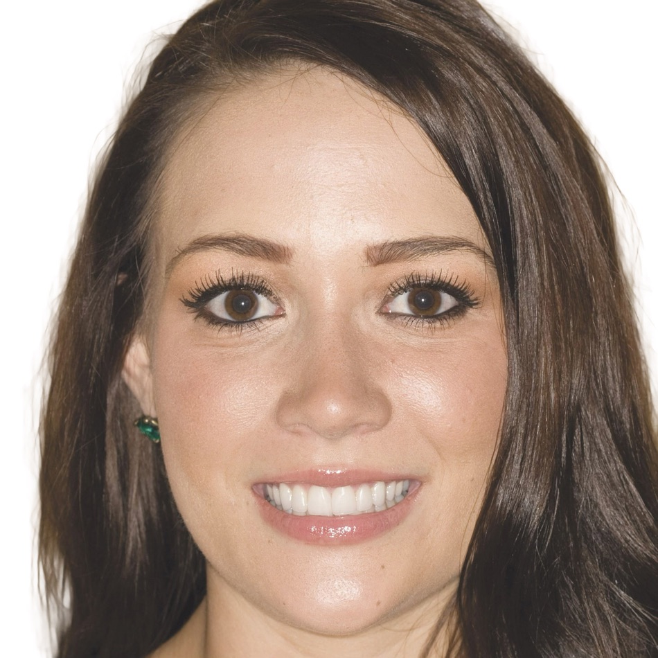 Patient smile after treatment