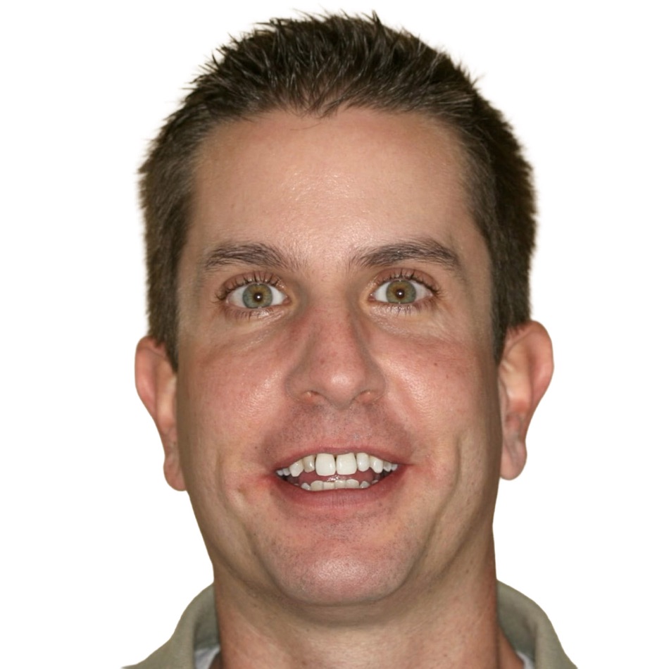 Patient smile before treatment