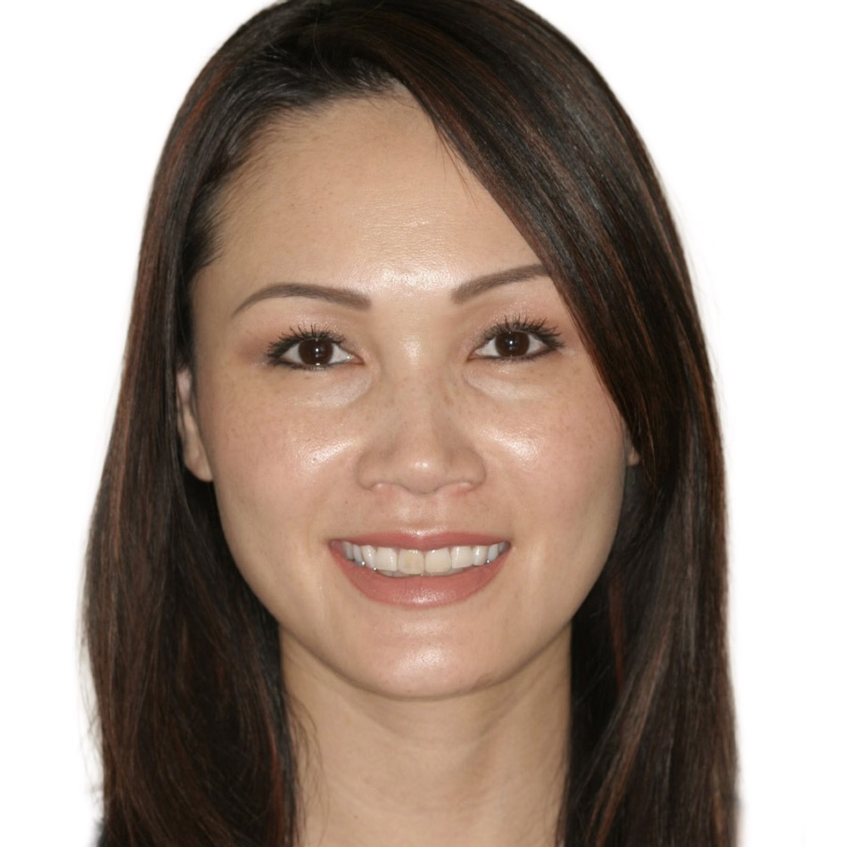 Patient smile before treatment