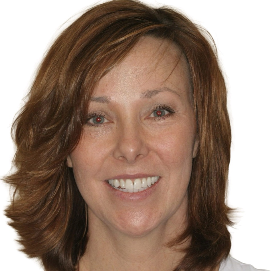Patient smile before treatment